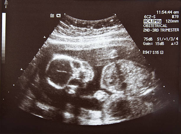 Роды после кесарева сечения через 1 год - важные аспекты