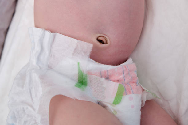 Обвитие пуповины вокруг шеи ребенка: причина и последствия